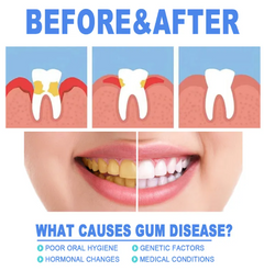 Teeth and Gum Gel